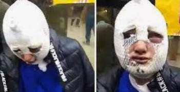 'Eski sözlüsünün saldırısına uğrayan genç kadın yaşadığı dehşeti anlattı'